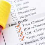 hyperlipidemia management