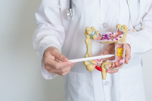colorectal cancer screening swetech medical center dr maria swetech