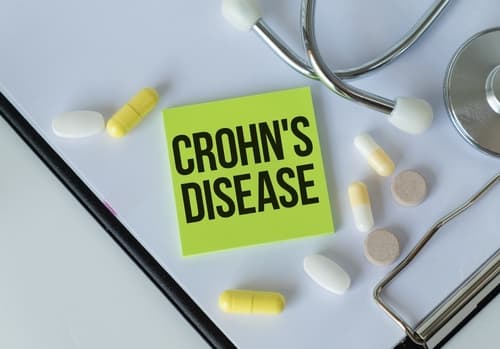 crohn's disease digestive disorders swetech medical center