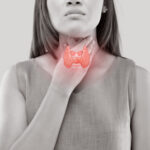 hyperthyroidism