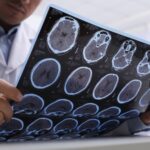 multiple sclerosis awareness dr maria swetech