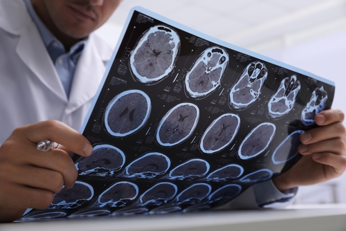 multiple sclerosis awareness dr maria swetech