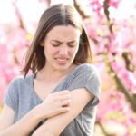 chronic condition eczema spring flare-up dr maria swetech
